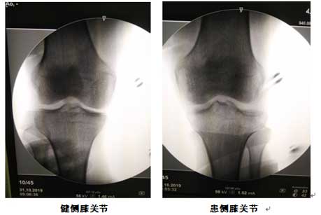 术前对比.jpg